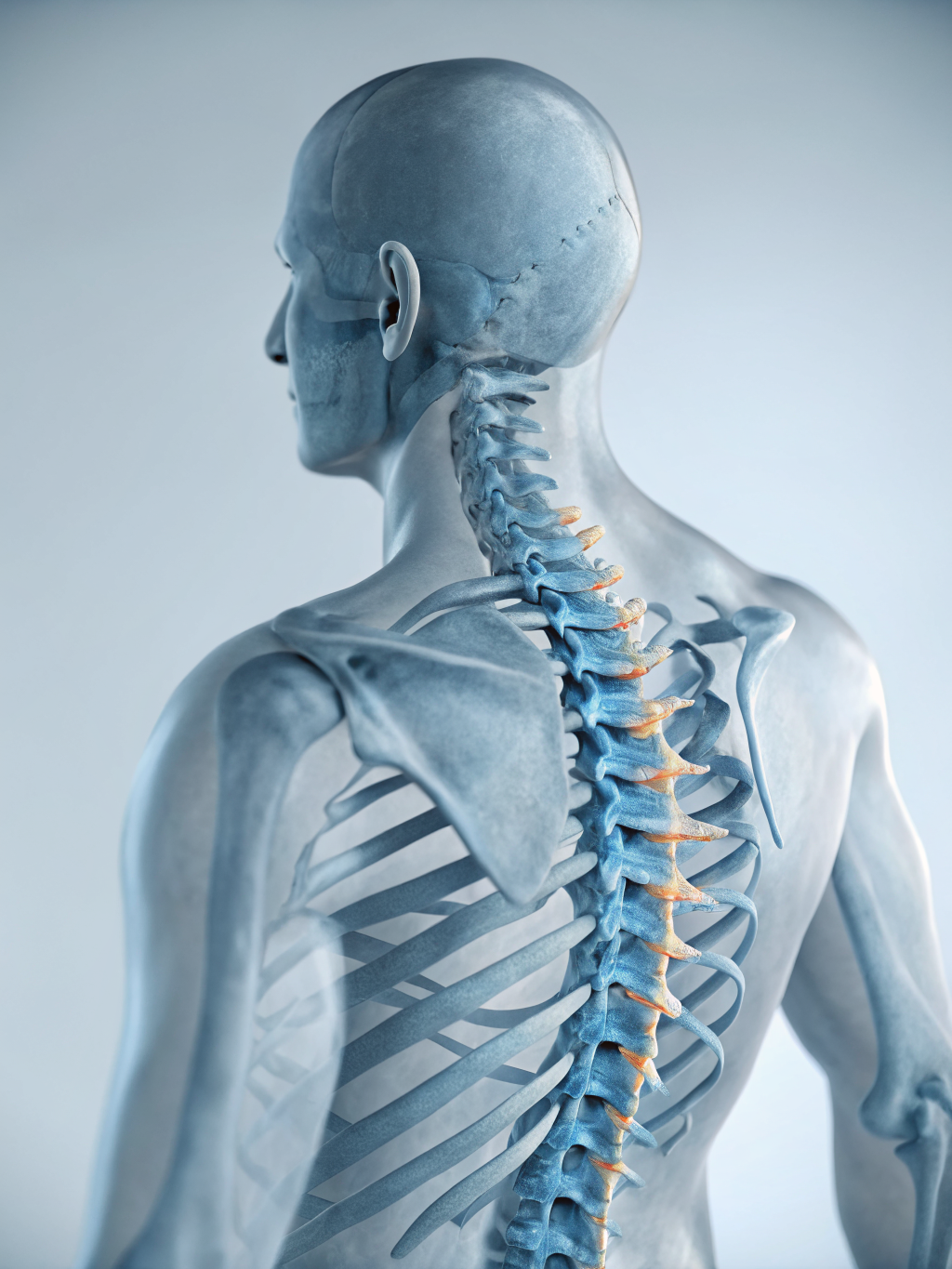 Medical illustration highlighting common delayed injury zones after a car accident